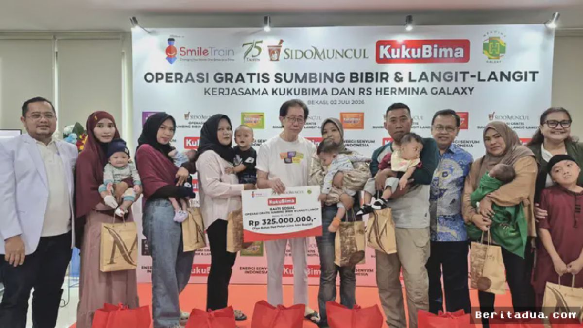 Sido Muncul dan Smile Train Indonesia Kolaborasi Gelar Operasi Gratis Sumbing Bibir di Bekasi